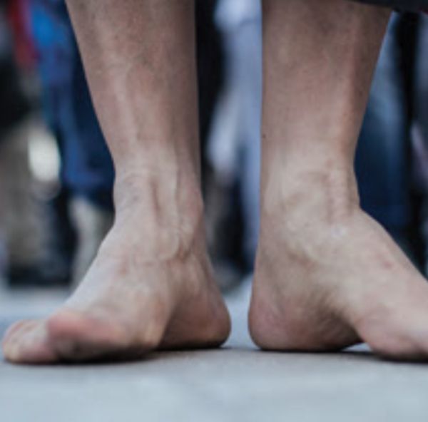 The Minim forbade excesses