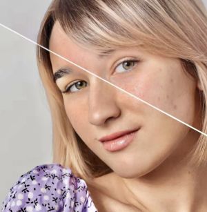 Bellezza che ferisce. E i veri Perfetti